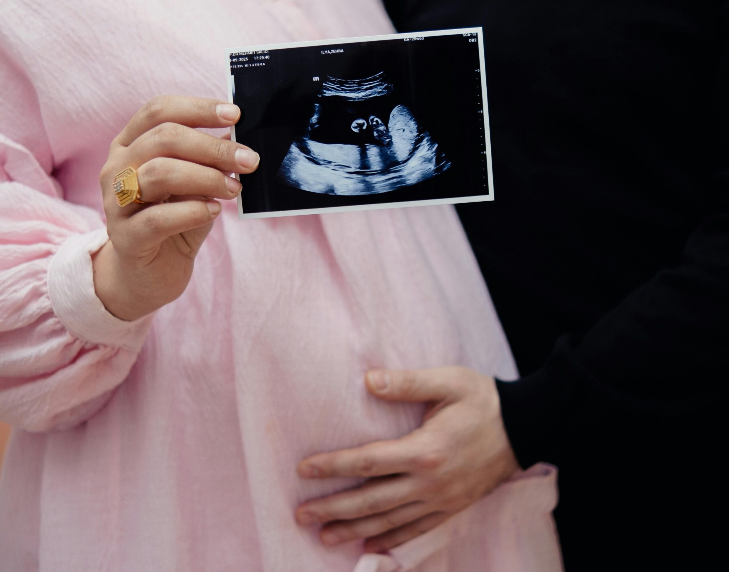 Zdjęcie do artykułu: Jak przygotować się do porodu – porady dla przyszłych mam